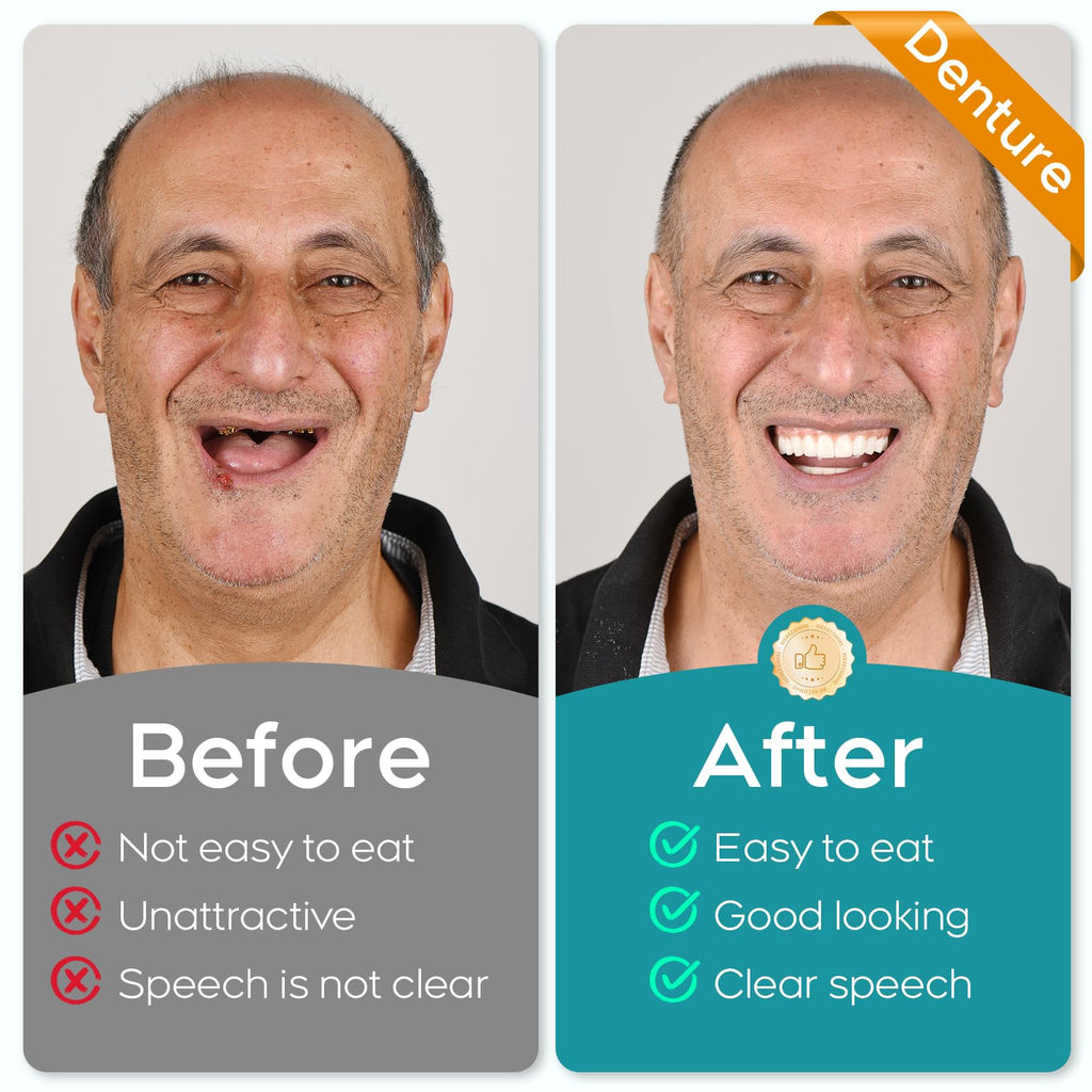 DIY Denture Kit Full Set Top & Bottom Fake Teeth Y524